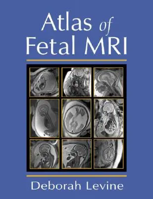 Atlas fetálnej magnetickej rezonancie - Atlas of Fetal MRI