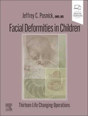 Deformácie tváre u detí: Trinásť operácií, ktoré zmenia život - Facial Deformities in Children: Thirteen Life Changing Operations
