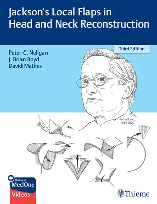 Jacksonove lokálne laloky pri rekonštrukcii hlavy a krku - Jackson's Local Flaps in Head and Neck Reconstruction