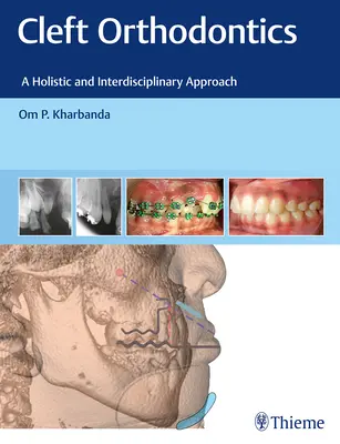 Rozštepová ortodoncia: Holistický a interdisciplinárny prístup - Cleft Orthodontics: A Holistic and Interdisciplinary Approach