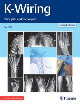 K-Wiring: Princípy a techniky - K-Wiring: Principles and Techniques