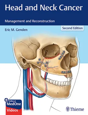 Rakovina hlavy a krku: Rukavica krku: manažment a rekonštrukcia - Head and Neck Cancer: Management and Reconstruction