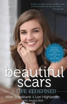 Krásne jazvy: Život na novo definovaný - Beautiful Scars: A Life Redefined