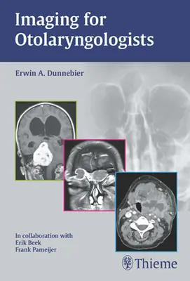 Zobrazovanie pre otolaryngológov - Imaging for Otolaryngologists