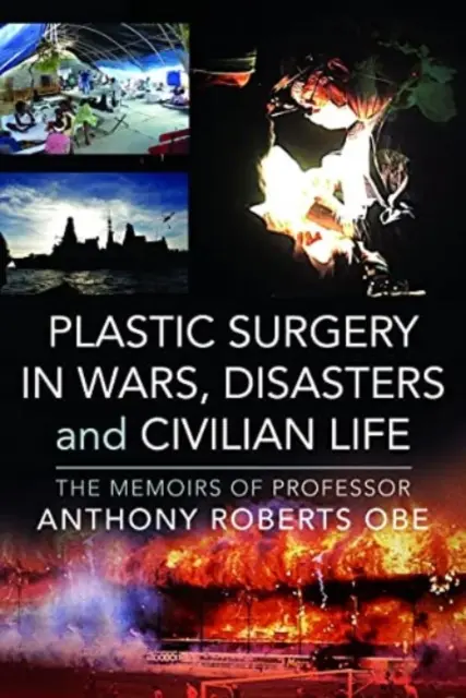 Plastická chirurgia vo vojnách, katastrofách a v civilnom živote: Spomienky profesora Anthonyho Robertsa OBE - Plastic Surgery in Wars, Disasters and Civilian Life: The Memoirs of Professor Anthony Roberts OBE