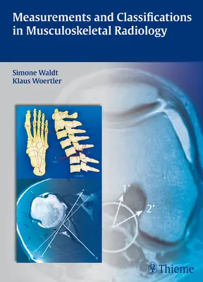 Merania a klasifikácie v muskuloskeletálnej rádiológii - Measurements and Classifications in Musculoskeletal Radiology