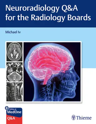 Neurorádiológia Otázky a odpovede k rádiologickým skúškam - Neuroradiology Q&A for the Radiology Boards