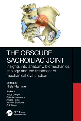 Obskúrny sakroiliakálny kĺb: Pohľad na anatómiu, biomechaniku, etiológiu a liečbu mechanickej dysfunkcie - The Obscure Sacroiliac Joint: Insights Into Anatomy, Biomechanics, Etiology and the Treatment of Mechanical Dysfunction