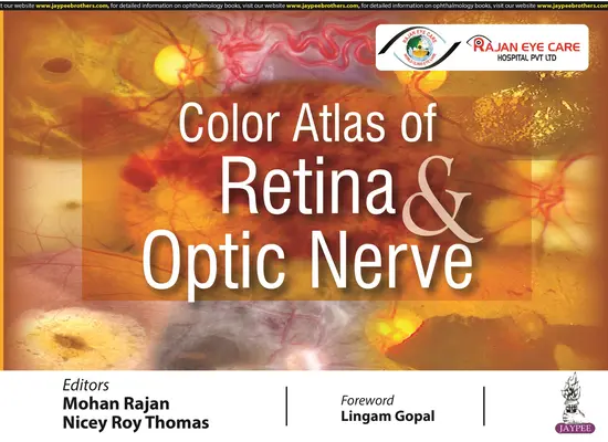 Farebný atlas sietnice a zrakového nervu - Color Atlas of Retina & Optic Nerve