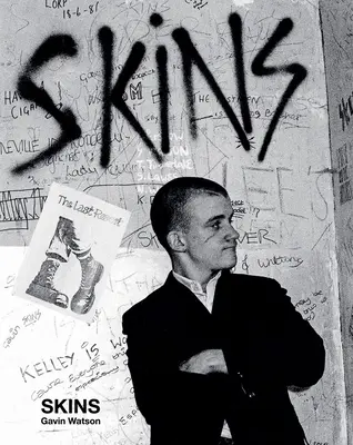 Koža: Gavin Watson - Skins: Gavin Watson