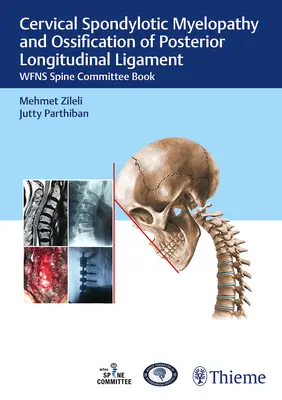 Cervikálna spondylotická myelopatia a osifikácia zadného pozdĺžneho väziva: Wfns Spine Committee Book - Cervical Spondylotic Myelopathy and Ossification of Posterior Longitudinal Ligament: Wfns Spine Committee Book
