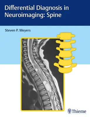 Diferenciálna diagnostika v neurozobrazovaní: Chrbtica - Differential Diagnosis in Neuroimaging: Spine