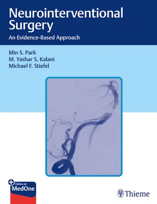 Neurointervenčná chirurgia: Prístup založený na dôkazoch - Neurointerventional Surgery: An Evidence-Based Approach