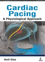 Kardiostimulácia a fyziologický prístup - Cardiac Pacing a Physiological Approach