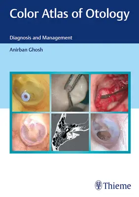 Farebný atlas otológie: Diagnostika a manažment - Color Atlas of Otology: Diagnosis and Management