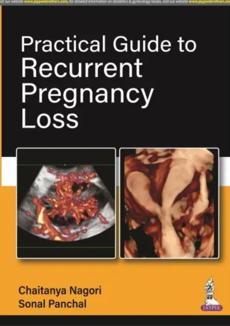Praktický sprievodca opakovanou stratou tehotenstva - Practical Guide to Recurrent Pregnancy Loss