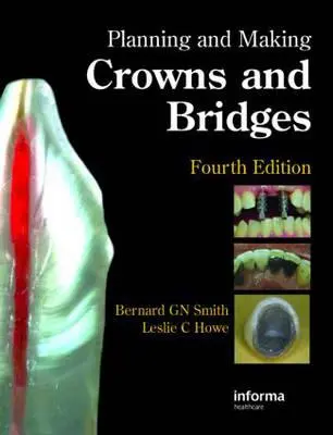 Plánovanie a zhotovovanie koruniek a mostíkov - Planning and Making Crowns and Bridges