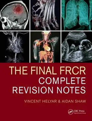 The Final Frcr: Kompletné poznámky k revízii - The Final Frcr: Complete Revision Notes