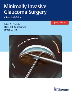 Minimálne invazívna chirurgia glaukómu: Praktická príručka - Minimally Invasive Glaucoma Surgery: A Practical Guide
