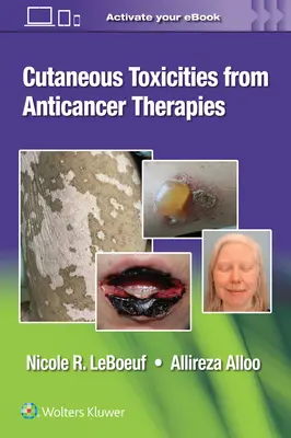 Kožné reakcie na protinádorovú liečbu - Cutaneous Reactions from Anti-Cancer Therapies
