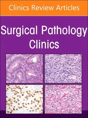 Endokrinná patológia, vydanie Kliniky chirurgickej patológie: Volume 16-1 - Endocrine Pathology, an Issue of Surgical Pathology Clinics: Volume 16-1