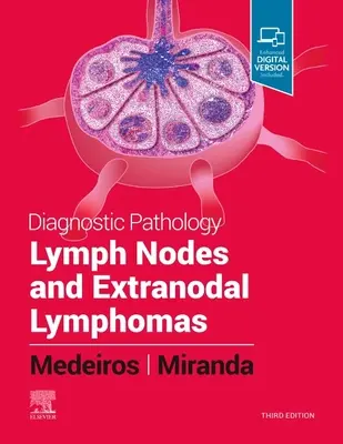 Diagnostická patológia: Lymfatické uzliny a extranodálne lymfómy - Diagnostic Pathology: Lymph Nodes and Extranodal Lymphomas
