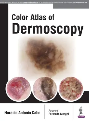 Farebný atlas dermoskopie - Color Atlas of Dermoscopy