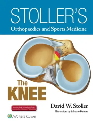 Stollerova ortopédia a športová medicína: Vrátane videozáznamov Stollerových prednášok a Stollerových poznámok - Stoller's Orthopaedics and Sports Medicine: The Knee: Includes Stoller Lecture Videos and Stoller Notes