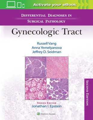 Diferenciálna diagnostika v chirurgickej patológii: Gynekologická patológia v gynekologickom trakte - Differential Diagnoses in Surgical Pathology: Gynecologic Tract