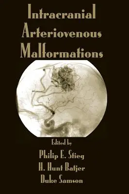 Intrakraniálne arteriovenózne malformácie - Intracranial Arteriovenous Malformations