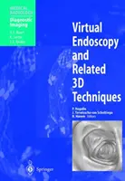 Virtuálna endoskopia a súvisiace 3D techniky - Virtual Endoscopy and Related 3D Techniques