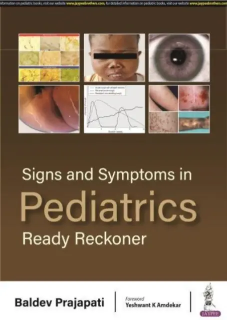 Príznaky a symptómy v pediatrii - Ready Reckoner - Signs and Symptoms in Pediatrics - Ready Reckoner