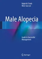 Alopécia u mužov: Príručka úspešného zvládania - Male Alopecia: Guide to Successful Management