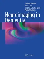 Neurozobrazovanie pri demencii - Neuroimaging in Dementia