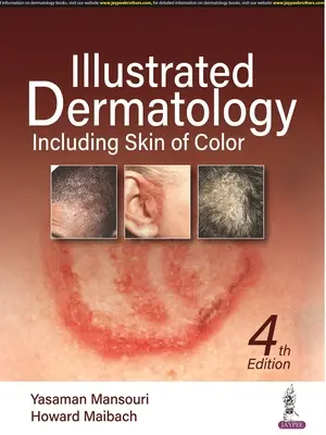Ilustrovaná dermatológia - vrátane farebnej kože - Illustrated Dermatology - Including Skin of Colour