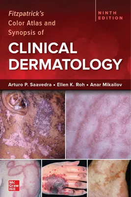 Fitzpatrick's Color Atlas and Synopsis of Clinical Dermatology, deviate vydanie - Fitzpatrick's Color Atlas and Synopsis of Clinical Dermatology, Ninth Edition