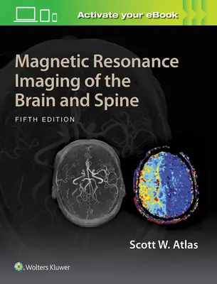 Magnetická rezonancia mozgu a chrbtice - Magnetic Resonance Imaging of the Brain and Spine