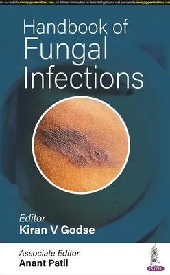Príručka o hubových infekciách - Handbook of Fungal Infections