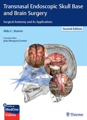 Transnazálna endoskopická chirurgia lebkovej bázy a mozgu: Chirurgická anatómia a jej aplikácie - Transnasal Endoscopic Skull Base and Brain Surgery: Surgical Anatomy and Its Applications