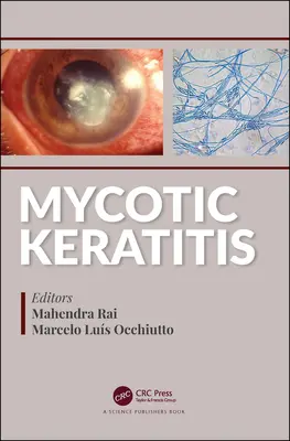 Mykotická keratitída - Mycotic Keratitis