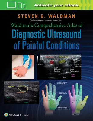 Waldmanov komplexný atlas diagnostického ultrazvuku bolestivých stavov - Waldman's Comprehensive Atlas of Diagnostic Ultrasound of Painful Conditions