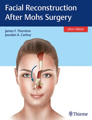 Rekonštrukcia tváre po Mohsovej operácii - Facial Reconstruction After Mohs Surgery