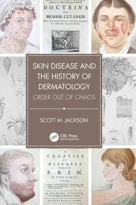 Kožné choroby a história dermatológie: Poriadok z chaosu - Skin Disease and the History of Dermatology: Order Out of Chaos