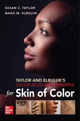 Farebný atlas a synopsa Taylor a Elbuluk pre farebnú pokožku - Taylor and Elbuluk's Color Atlas and Synopsis for Skin of Color