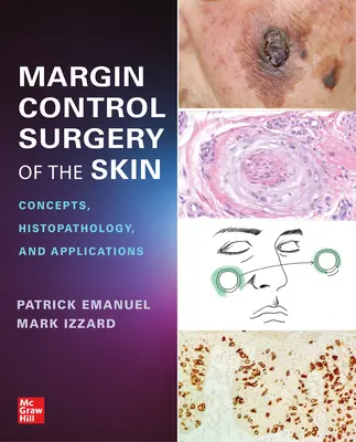 Chirurgia kontroly okrajov kože: Koncepcie, histopatológia a aplikácie - Margin Control Surgery of the Skin: Concepts, Histopathology, and Applications