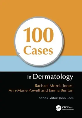 100 prípadov z dermatológie - 100 Cases in Dermatology