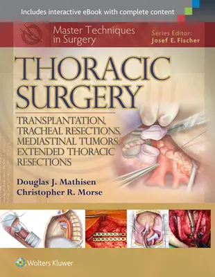 Majstrovské techniky v chirurgii: Hrudná chirurgia: Hrudná chirurgia: transplantácie, resekcie priedušnice, nádory mediastína, rozšírené hrudné resekcie - Master Techniques in Surgery: Thoracic Surgery: Transplantation, Tracheal Resections, Mediastinal Tumors, Extended Thoracic Resections