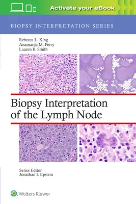 Interpretácia biopsie lymfatických uzlín - Biopsy Interpretation of the Lymph Node