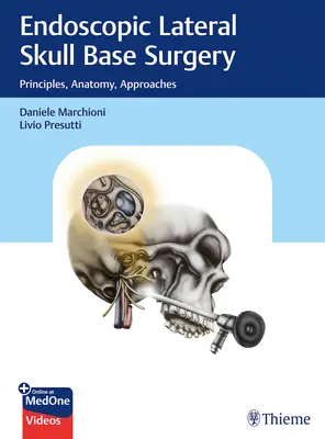 Endoskopická chirurgia bočnej lebkovej bázy: Princípy, anatómia, prístupy - Endoscopic Lateral Skull Base Surgery: Principles, Anatomy, Approaches