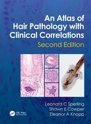 Atlas patológie vlasov s klinickými koreláciami - An Atlas of Hair Pathology with Clinical Correlations